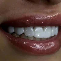 خدمات دندانپزشکی لمینت دندان کامپوزیت ودرمانی|خدمات آرایشگری و زیبایی|تهران, فلسطین (میدان انقلاب)|دیوار