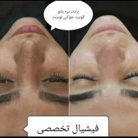 پاکسازی،فیشیال تخصصی،درمان مشکلات پوستی(تخفیف)|خدمات آرایشگری و زیبایی|گرگان, |دیوار