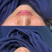 کلینیک زیبایی آفتاب|خدمات آرایشگری و زیبایی|سقز, |دیوار