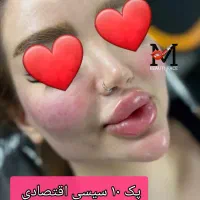 تزریق ژل و بوتاکس،مادلینگ