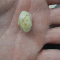 انواع سنگ قیمتی بفروش میرسد فوری|کلکسیون اشیاء عتیقه|کرج, کیانمهر|دیوار