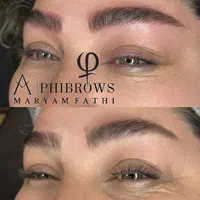 میکروبلیدینگ حرفه‌ای با قیمت ویژه