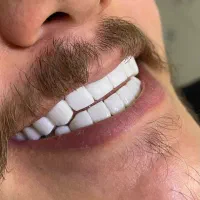 کامپوزیت فقط فکی ۱۶ تومن وآموزش  روز کامپوزیت|خدمات آرایشگری و زیبایی|تهران, شمشیری|دیوار