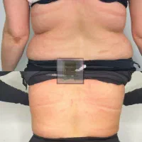 جشنواره ۵۰درصدی فیلرباسن