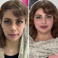 جشنواره ژل لب فیلرمزو1050بوتاکس950 پزشک متخصص|خدمات زیبایی و سلامت|مشهد, سجاد شهر|دیوار