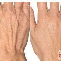 انواع خدمات زیبایی صورت و بدن|خدمات آرایشگری و زیبایی|اصفهان, ملک‌شهر|دیوار