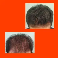 ( برای پیشرفت عجله کن )