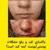 فقط روغن طبیعی وارگانیک نتیجه داره|آرایشی، بهداشتی، درمانی|جیرفت, |دیوار