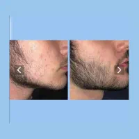 این صورت جای ریش داره، نه جای ناامیدی