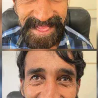 دندان مصنوعی از دم قسط|خدمات آرایشگری و زیبایی|اصفهان, شیخ طوسی|دیوار