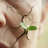 بوتاکس،فیلر،ژل