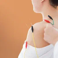 طب سوزنی تخصصی(اکوپانچریست)،امبدینگ لاغری|خدمات زیبایی و سلامت|تهران, دبستان|دیوار