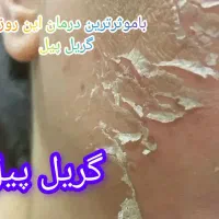 فشیال و پاکسازی پوست وآلگاپیل