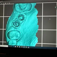 دستیار دندانپزشک