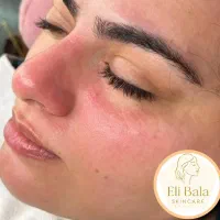 پاکسازی پوست