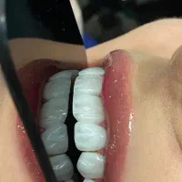 دندانپزشکی اقساطی با اسنپ‌پی