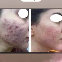 ادمین پیج اینستگرام کیلینیک زیبایی