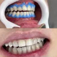 دندانپزشکی|خدمات آرایشگری و زیبایی|شیراز, شهرک گلدشت حافظ‎|دیوار