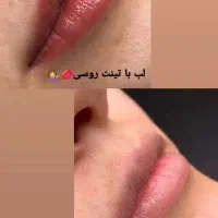 فرصت استثنایی
