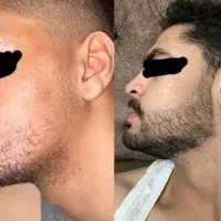 وقت پرتر شدن مو و ریشته|آرایشی، بهداشتی، درمانی|کرج, جهان‌شهر|دیوار