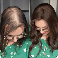 پروتزمو زنانه مردانه بدون واسطه قیمت عمده خرید کن|آرایشی، بهداشتی، درمانی|تهران, زعفرانیه|دیوار