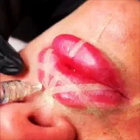 افتتاح لاین زیبایی تزریق چربی،فیلر