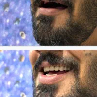 دندانسازی کرمان