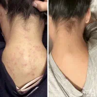 جوانسازی فوری/در یک جلسه/در یک ساعت|خدمات آرایشگری و زیبایی|رشت, کوی حسینی|دیوار