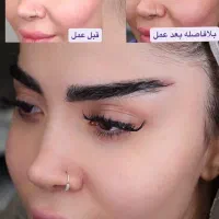 دایرکت ابرو ولیفت شقیقه نقد واقساط