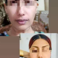 جراحی لابیا پلاستی .چربی صورت وبدن|خدمات آرایشگری و زیبایی|رباط‌کریم, رباط‌کریم|دیوار