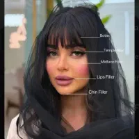 هایفوحرفه ایی،مزو،فیلر،فشیال وprpبدون درد و ورم