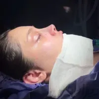 جراحی و عمل بینی/پیکرتراشی/لیفت/پلک