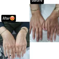 پاکسازی پوست،اموزش تخصصی،رفع تیرگی بدن