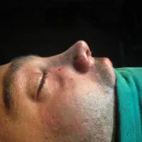 جراحی بینی ۲۴میلیون|خدمات آرایشگری و زیبایی|اسلامشهر, شهرک قائمیه|دیوار