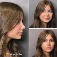جراحی بینی با تخفیف استثنایی بمدت محدود فقط ۳۹/۹۰۰