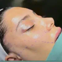 صفرتا صد جراحی۴۶تومن (تعداد محدود)|خدمات زیبایی و سلامت|تهران, جهاد|دیوار
