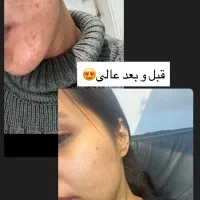پاکسازی پوست اکستنشن مژه فقط 1250
