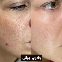 کرم 5 کاره|آرایشی، بهداشتی، درمانی|شیراز, میانرود|دیوار