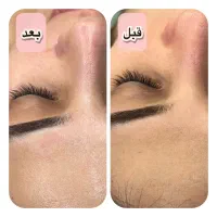 پوست سالم میخوای من کمکت میکنم فیشال بانوان|خدمات آرایشگری و زیبایی|شیراز, بعثت|دیوار