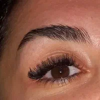 کاشت هیدن رایگان