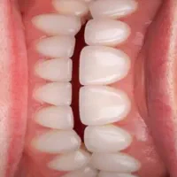 دندانپزشکی/کامپوزیت/ لمینیت/ ایمپلنت/ روکش|خدمات آرایشگری و زیبایی|تهران, هفت حوض|دیوار