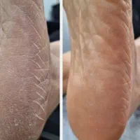 مدل ناخن،آموزش ناخن با قیمت باورنکردنی|خدمات آرایشگری و زیبایی|اندیشه, اندیشه فاز ۱|دیوار