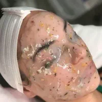 تخفیفات ویژه خدمات آموزش فشیال اکستنشن هیدن لیفت|خدمات آرایشگری و زیبایی|قرچک, میرزائی شمالی|دیوار