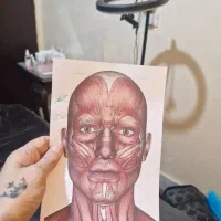 آموزش تزریق ژل لب.ژل گونه بوتاکس انواع مزوتراپی