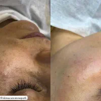 خدمات فیشال و پاکسازی پوست|خدمات آرایشگری و زیبایی|اهواز, زیتون کارگری|دیوار