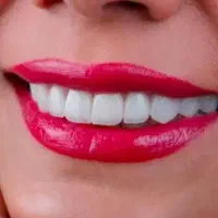 کامپوزیت دندان سارمکو کاریزما آی پی اس الترادنت|خدمات زیبایی و سلامت|تهران, نارمک جنوبی|دیوار