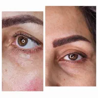 کلینیک رویال دورود|خدمات آرایشگری و زیبایی|دورود, |دیوار