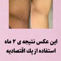 آرایشی بهداشتی|خدمات آرایشگری و زیبایی|اهواز, امانیه|دیوار