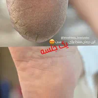 جهت تکمیل آلبوم|خدمات آرایشگری و زیبایی|رشت, گلباغ نماز|دیوار