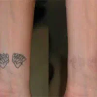 جشنواره  پاک کردن تتو و حذف لک ،کک و مک تضمینی